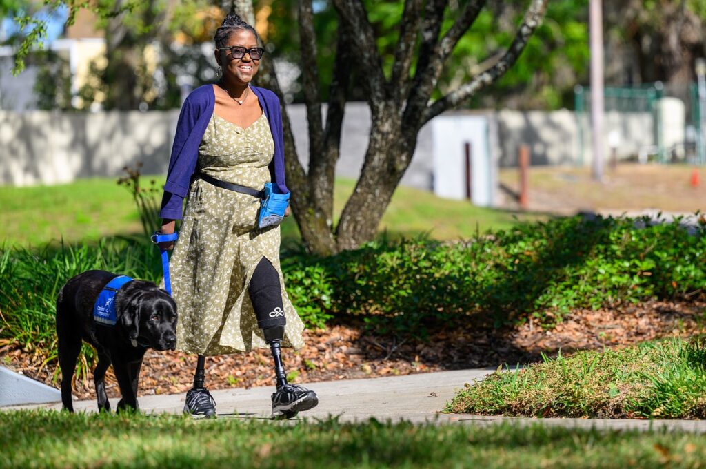 Woman with two prosthetic legs walking a black service dog in a sunlit park, wearing a floral dress and cardigan.